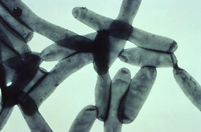 レジオネラ属菌の参考画像